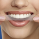 14 Treatments- Crests 3D Whitestrips | $27 | Amazon | Clip the $5 coupon